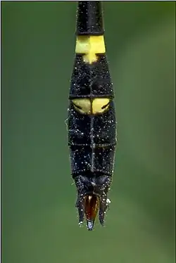 Anal appendages