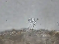 A zoosporangium of Phlyctochytrium sp. on a duckweed frond. The zoosporangium is empty, and the spines that had crowned it are folded back. Suspended above the empty zoosporangium is a mass of zoospores.