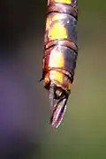 Anal appendages (female)