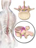 Dura mater (spinal section)
