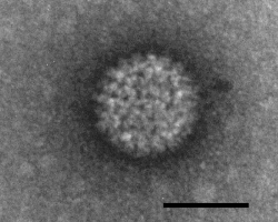 Negatively stained Bluetongue virus–like particle that caused a cytopathic effect in BHK-21 cells. Scale bar = 50 nm