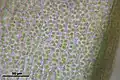 Leaf cells
