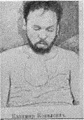 Dead Kazimir Kovalevich