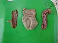 PM lesions on proventriculus, gizzard, and duodenum