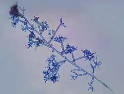 "Fonsecaea pedrosoi"