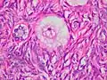 Primordial ovarian follicle. The oocyte is surrounded by a single layer of flat granulosa cells.