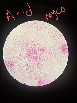 Photomicrograph of pink, innumerate small organisms unevenly distributed