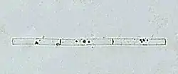 Leptocylindrus danicus as seen down a microscope