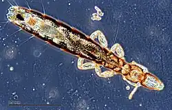 A photo of a long slender louse underneath a microscope