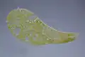 Stentor polymorphus with algal symbionts