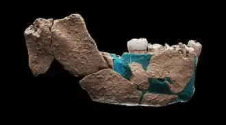 Mandible (lower jaw