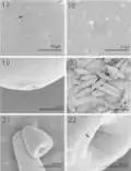 SEM of mature specimens of Echinorhynchus baeri