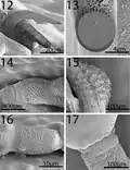 Scanning electron microscopy of Neoandracantha peruensis