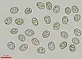 Basidiospores