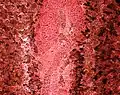 Ovary
