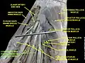 Common palmar digital branches of median nerve