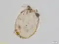Test of Amphitrema, a testate amoeba recently included in the group